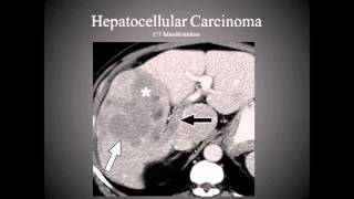 The Hepatobiliary System [upl. by Atsiuqal]