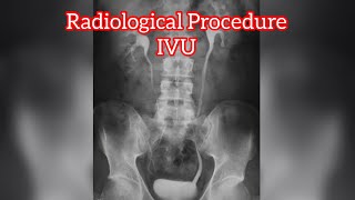 IVU  IVP Procedure  Radiology Procedure  Radiographer  Rso [upl. by Aicirt]