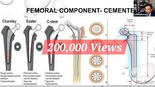 Biomechanics of Total Hip Replacement for the FRCSOrth [upl. by Eissim]