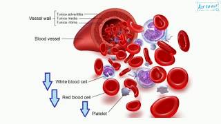 pancytopenia English  Medical terminology for medical students [upl. by Quenna]