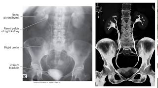 Radiographic Contrast Studies of the Urinary System [upl. by Cone]