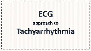 ECG Approach to Tachyarrhythmia SVT PSVT Atrial Fibrillation Ventricular Tachycardia [upl. by Budworth]