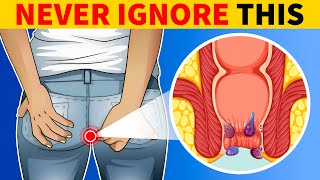 6 Signs of Colon Cancer You Should Know [upl. by Zetes293]