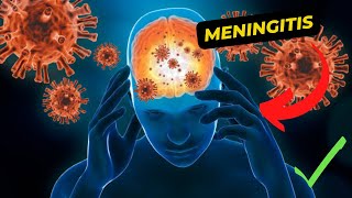 Understanding Meningitis Symptoms Causes Treatment and Prevention [upl. by Yrrap]