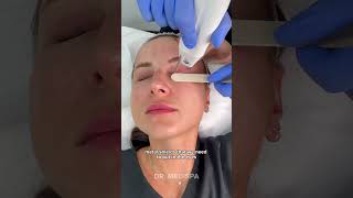 Eye REJUVENATION with Agejet Eyes  Dr Medispa [upl. by Goldina]