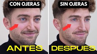 Como eliminar facilmente las OJERAS OSCURAS y Las BOLSAS [upl. by Marlen]