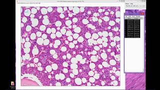 Cómo calcular diámetro teórico con ImageJ  Análisis digital de Imágenes  Curso en Línea 4014 [upl. by Ellenhoj668]