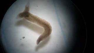 Twoheaded Planarian Planaria Regeneration Experiment [upl. by Renmus]