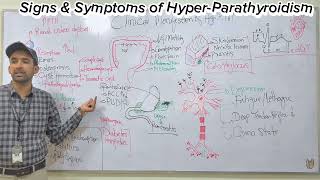 Hyper  ParaThyroidismClinical Manifestations in HindiUrdu [upl. by Duck]