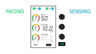 Temporary Epicardial Pacemakers and Sensitivity [upl. by Eniamor733]