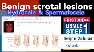 Benign scrotal lesions Hydrocele amp Spermatocele in HindiUrdu by first aid for USMLE step 1 [upl. by Eldoree731]