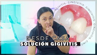 Gingivitis Tratamiento casero  Causas y soluciones [upl. by Lebazi]