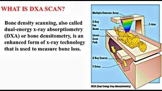 Bone Densitometry  Medical PowerPoint Presentation [upl. by Adlesirk]