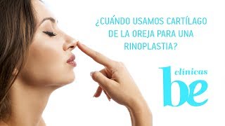 Cuándo usamos cartílago de oreja para una rinoplastia o cirugía nariz  Clínicas Be [upl. by Meda]