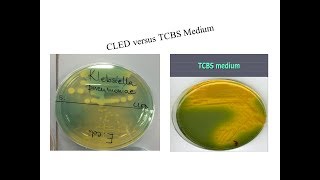 various bacterial growth in CLED and TCBS [upl. by Sivatco]