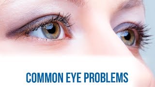 Common Eye Problems hindi [upl. by Idac]