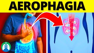 Aerophagia Medical Definition  Quick Explainer Video [upl. by Milburn308]