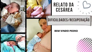 RELATO DE PÓS PARTOSE RECUPERANDO DA CESÁREA [upl. by Buine]