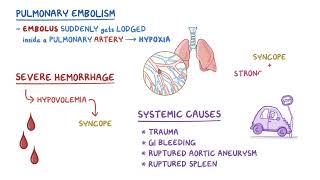 Clinical Reasoning  Syncope  Osmosis [upl. by Torrence]