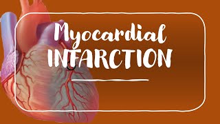 Myocardial Infarction and Angina for USMLE Step 1 and USMLE Step 2 [upl. by Yrok]