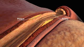 LDL and HDL Cholesterol  Good and Bad Cholesterol  Nucleus Health [upl. by Sholes]