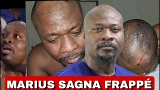 ⛑Urgence Les cicatrices visibles de lagression de Guy Marius Sagna au Togo [upl. by Zulema]