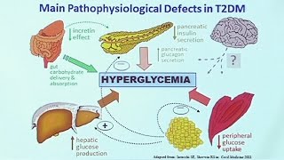 Making Sense of Diabetic Medications [upl. by Nohtanhoj]