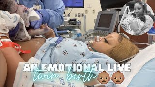 THE LIVE BIRTH OF OUR SECOND SET OF TWINS  Real Raw amp Emotional Doctor Turns Breech Baby in Womb [upl. by Zalucki85]