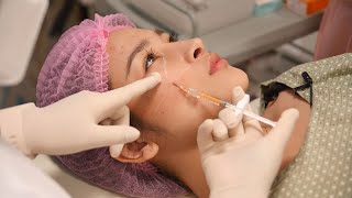 Dermal Filler Injection Techniques [upl. by Hank]