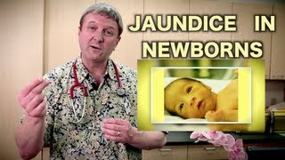 Jaundice in Newborns Pediatric Advice [upl. by Carlin]