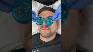 Relaxing facial ice globes  Dr Medispa [upl. by Winstonn31]