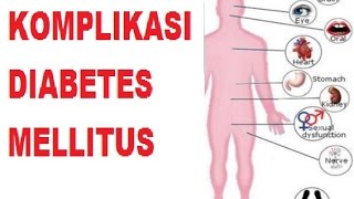 Apakah Komplikasi Diabetes Mellitus itu [upl. by Sirrap]