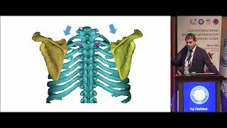 Scapulothoracic Problems [upl. by Woodsum]