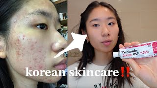 HOLY GRAIL skincare CLEARED my acne with tretinoin [upl. by Nickles627]