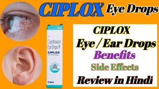 Ciplox Eye  Ear Drops Review in hindi  Ciplox Eye Drops benefitsside effecthealth [upl. by Juno]