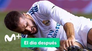 El Día Después 21082017 El balón de la discordia [upl. by Tik343]