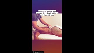 How to remove ingrown hair post waxing aftercare advice from Alexspot24 Men spa [upl. by Hodosh222]