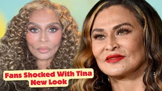 Tina Knowles’s Controversial BUCCAL FAT Removal Surgery  Look At Her Face Yikes [upl. by Aiket345]