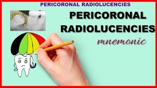 Pericoronal Radiolucency Mnemonic Series 20 [upl. by Jezrdna575]