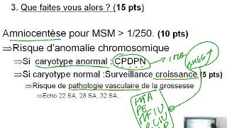 Dossier PAE  Gynéco Obstétrique 03 [upl. by Lacie455]