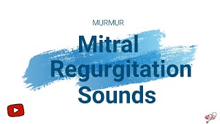 Mitral Valve Regurgitation Sound  Murmur  MR [upl. by Nimajnab890]