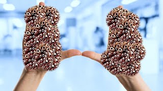 ASMR removal trypophobia infected hand  ASMR severely loosing hand drawn  ASMR treatment animation [upl. by Hedda]