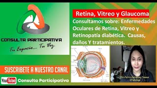 Patologías Oculares de Retina Vitreo y Retinopatía diabética Causas y Daños Consulta P 121124 [upl. by Llezniuq]