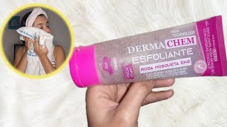 GEL ESFOLIANTE ROSA MOSQUETA com ácido hialurônico e íons Colágeno DERMACHEM [upl. by Yenrab]