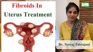 बच्चेदानी में गठान के लक्षण और ऑपरेशन करे या नहीं  Fibroid In Pregnancy [upl. by Gardia]