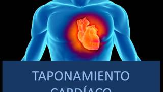 Taponamiento cardíaco  Fisiopatología [upl. by Cas644]