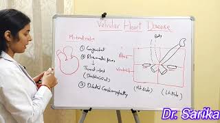 10 VALVULAR HEART DISEASE [upl. by Megen190]