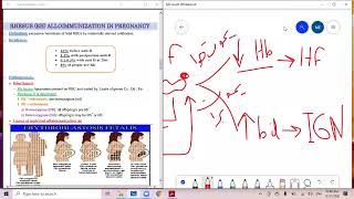 د السكري erythroblastosis fetalis rh [upl. by Tibbetts]