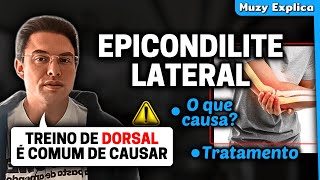 EPICONDILITE LATERAL DO COTOVELO  Muzy Explica [upl. by Nirak]