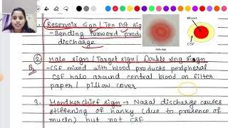 CSF rhinorrhea  causes symptoms Signs diagnosis treatment [upl. by Coral954]